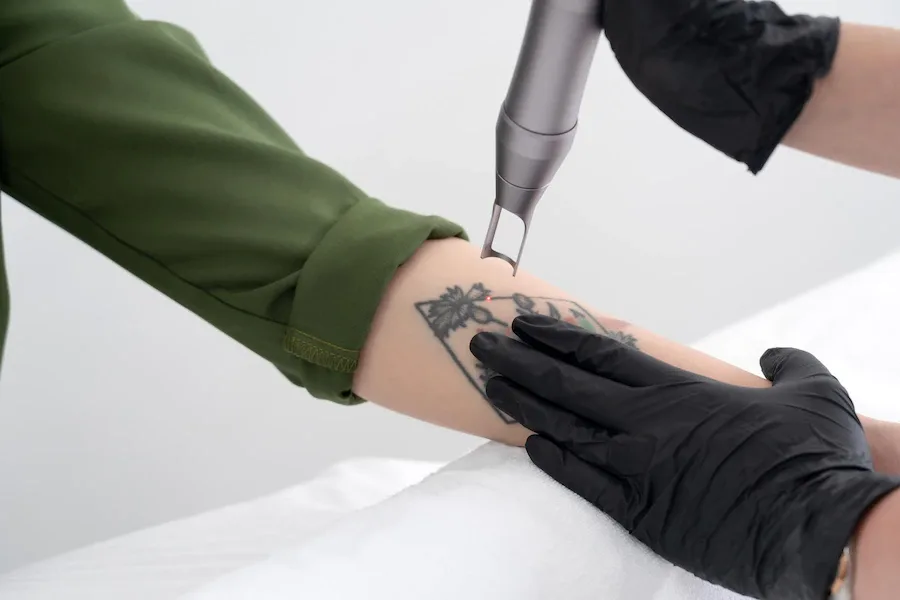 Tatuaż i znieczulenie ogólne - czy to możliwe?